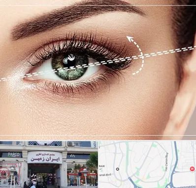 جراحی چشم گربه ای در ایران زمین