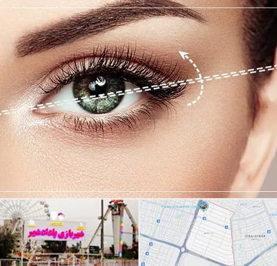 جراحی چشم گربه ای در پادادشهر اهواز