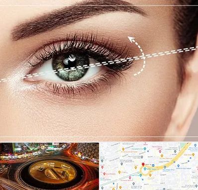 جراحی چشم گربه ای در میدان ولیعصر 