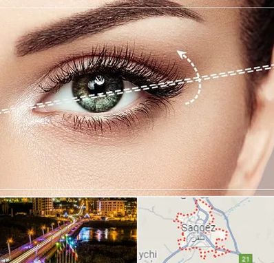 جراحی چشم گربه ای در سقز