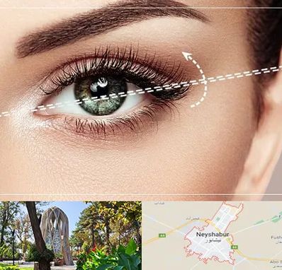 جراحی چشم گربه ای در نیشابور
