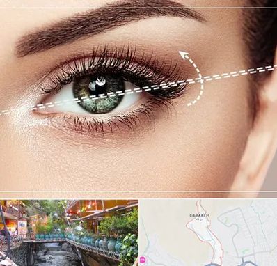 جراحی چشم گربه ای در درکه