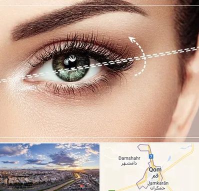 جراحی چشم گربه ای در قم