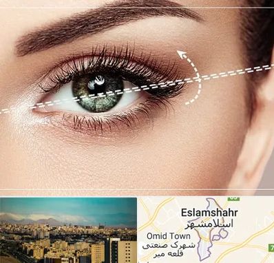 جراحی چشم گربه ای در اسلامشهر