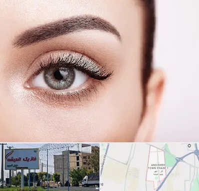 فوق تخصص عنبیه در فاز یک اندیشه