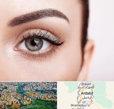 فوق تخصص عنبیه در اردبیل