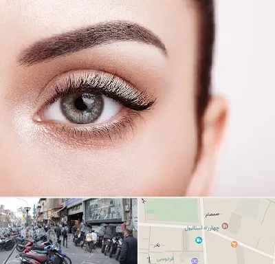 فوق تخصص عنبیه در چهارراه استانبول