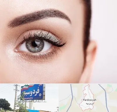 فوق تخصص عنبیه در فردوسیه شهریار