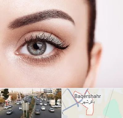 فوق تخصص عنبیه در باقرشهر