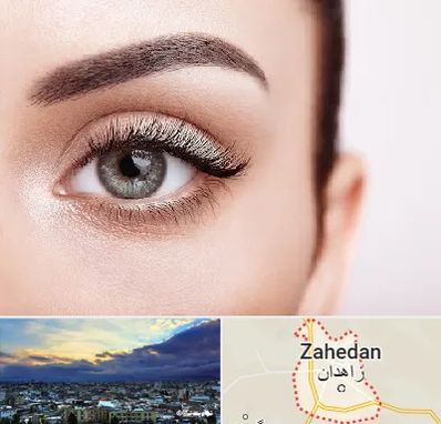 فوق تخصص عنبیه در زاهدان