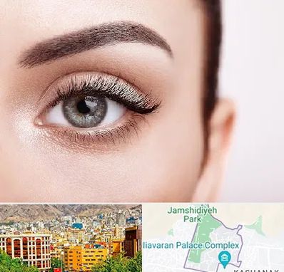 فوق تخصص عنبیه در نیاوران 