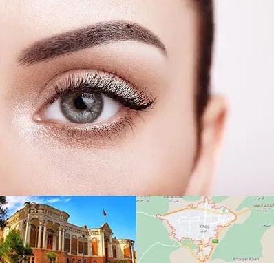 فوق تخصص عنبیه در خوی