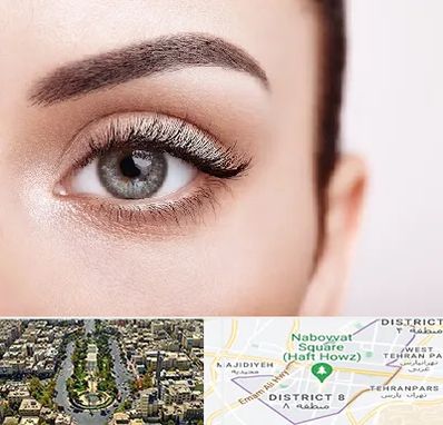 فوق تخصص عنبیه در نارمک 