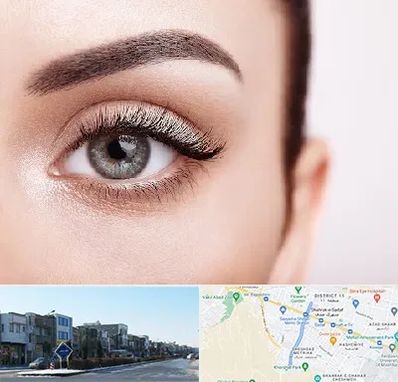 فوق تخصص عنبیه در شریعتی مشهد