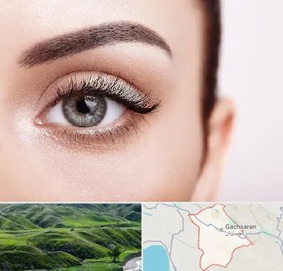 فوق تخصص عنبیه در گچساران