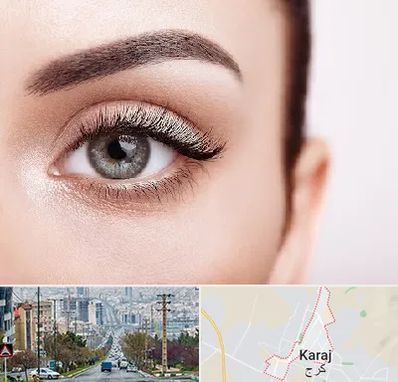 فوق تخصص عنبیه در گوهردشت کرج 