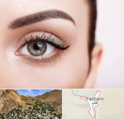 فوق تخصص عنبیه در فشم