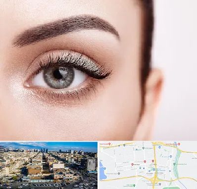 فوق تخصص عنبیه در شهرک راه آهن