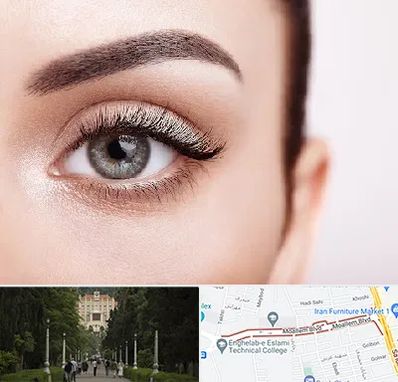 فوق تخصص عنبیه در بلوار معلم رشت 