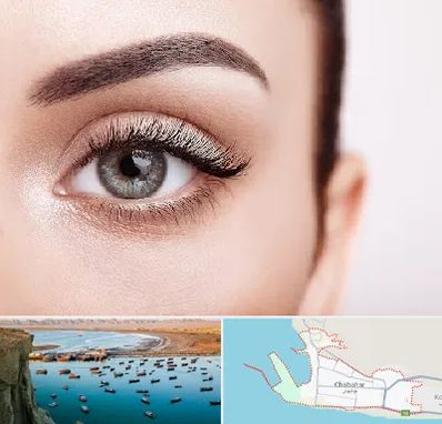 فوق تخصص عنبیه در چابهار