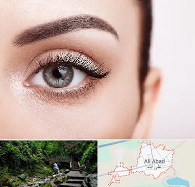 فوق تخصص عنبیه در علی آباد کتول