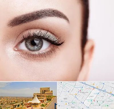 فوق تخصص عنبیه در هاشمیه مشهد