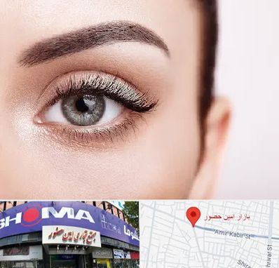 فوق تخصص عنبیه در امین حضور