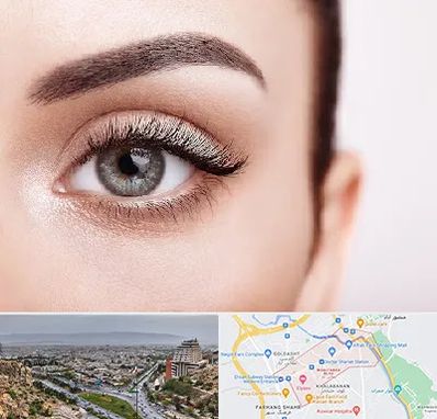 فوق تخصص عنبیه در معالی آباد شیراز