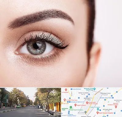 فوق تخصص عنبیه در شریعتی 