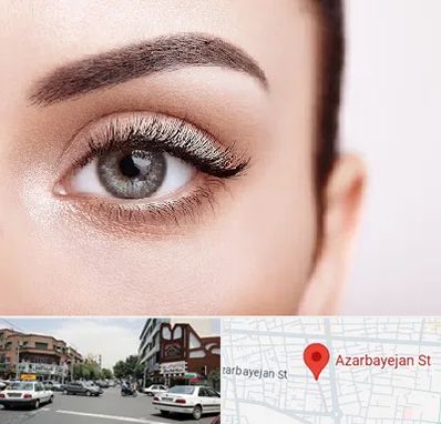 فوق تخصص عنبیه در خیابان آذربایجان
