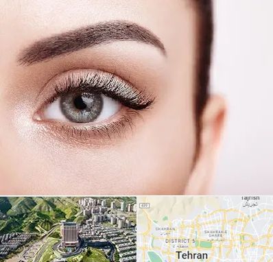 فوق تخصص عنبیه در شمال تهران 