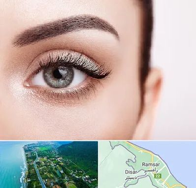 فوق تخصص عنبیه در رامسر