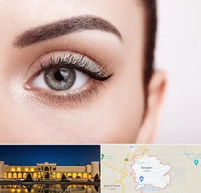 فوق تخصص عنبیه در برازجان