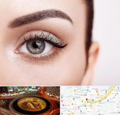 فوق تخصص عنبیه در میدان ولیعصر 