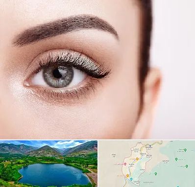 فوق تخصص عنبیه در رودبار