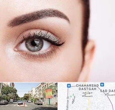 فوق تخصص عنبیه در چهارصد دستگاه 