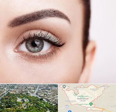 فوق تخصص عنبیه در شهرکرد