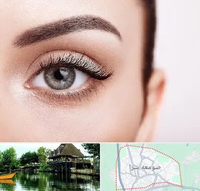 فوق تخصص عنبیه در صومعه سرا