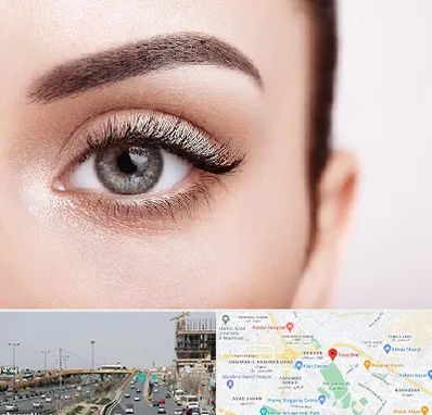 فوق تخصص عنبیه در بلوار توس مشهد 