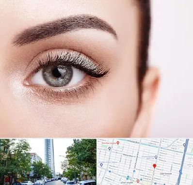 فوق تخصص عنبیه در امامت مشهد