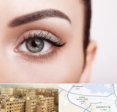 فوق تخصص عنبیه در جنوب غرب تهران