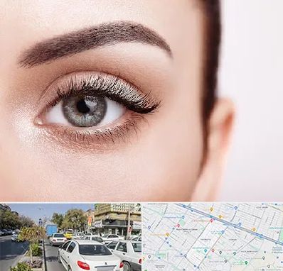 فوق تخصص عنبیه در مفتح مشهد