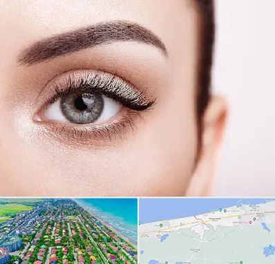 فوق تخصص عنبیه در فریدونکنار