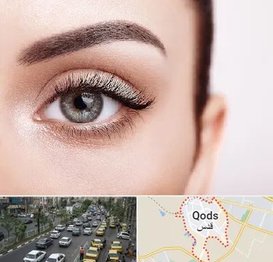 فوق تخصص عنبیه در شهر قدس