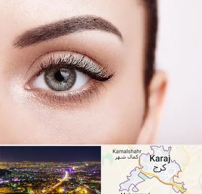فوق تخصص عنبیه در کرج