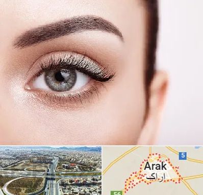 فوق تخصص عنبیه در اراک