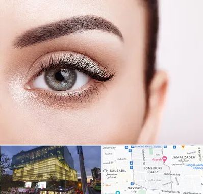 فوق تخصص عنبیه در جمهوری 