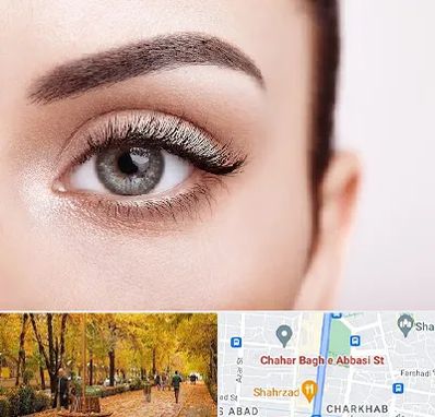 فوق تخصص عنبیه در چهارباغ اصفهان