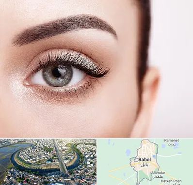 فوق تخصص عنبیه در بابل