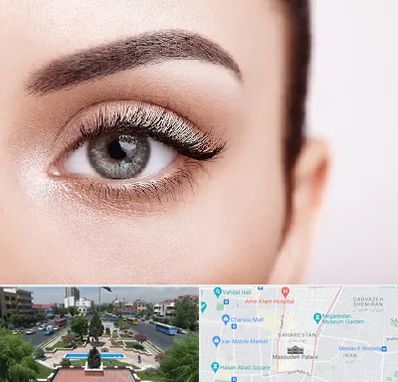 فوق تخصص عنبیه در بهارستان 